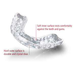 顎関節症(TMJ) 顎関節症(TMJ)