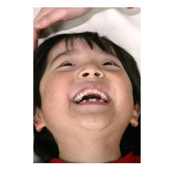小児歯科 小児歯科